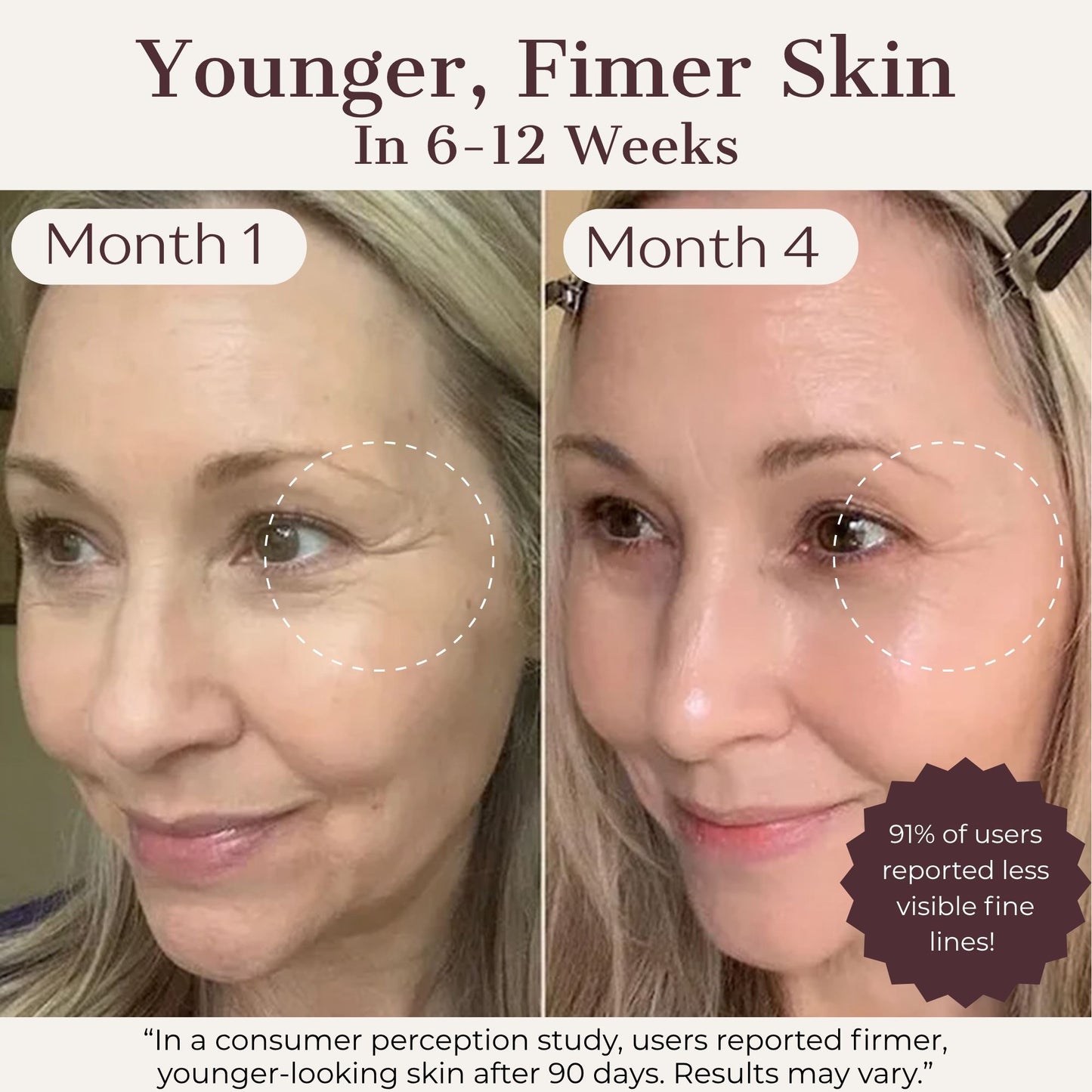 Hatch Halo™ Dermatologist-Grade Light Mask, From Home