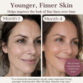 Hatch Halo™ Dermatologist Grade 3-in-1 Light Therapy Mask
